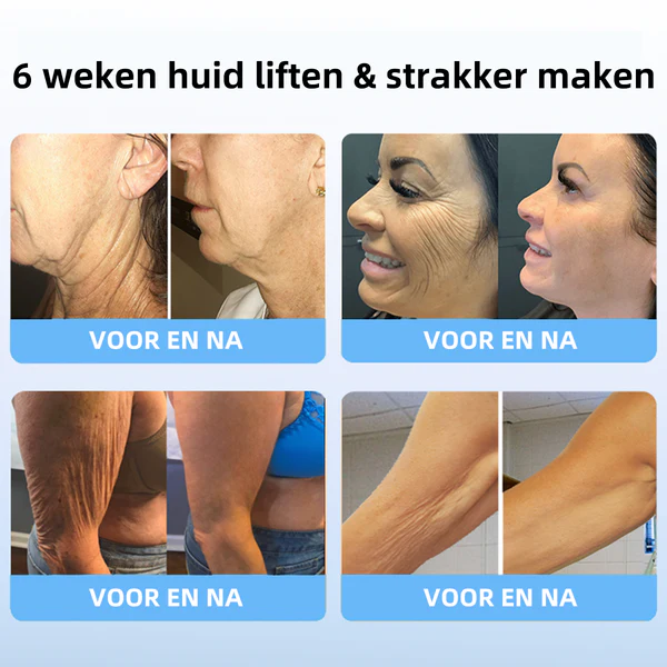 Skinfirming Creme Firmador para Flacidez